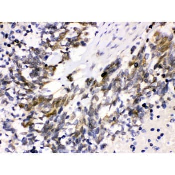 CDK4 Antibody (aa201-303)