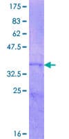 Human ASIP Protein (Recombinant GST, N-terminus)
