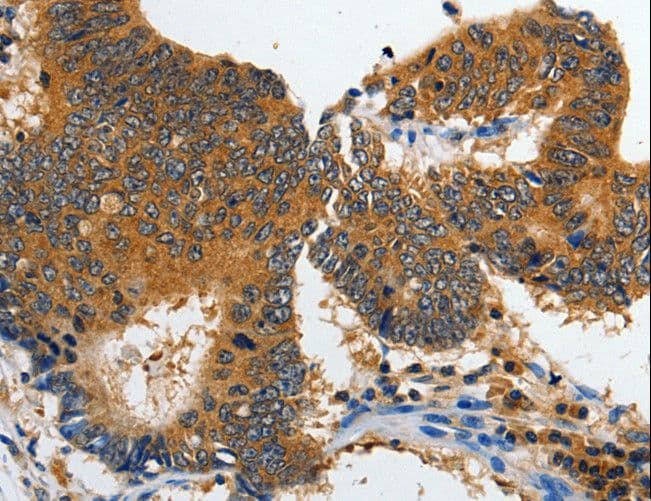 Polyclonal Rabbit anti-Human GRIA2 / GLUR2 Antibody (IHC)