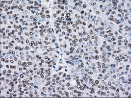Monoclonal Mouse anti-Human PSMD10 / Gankyrin Antibody (clone OTI3F6, WB)