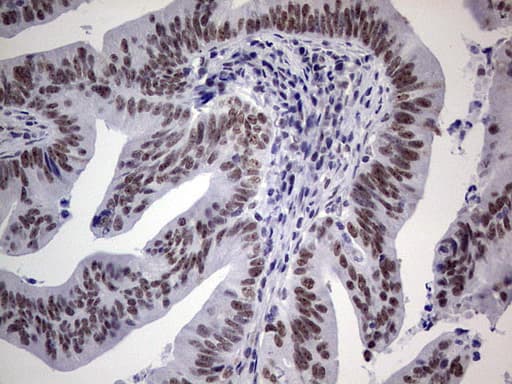 Monoclonal Mouse anti-Human TLK2 Antibody (clone OTI2C1, Carrier-free, aa1-296, IHC, WB)