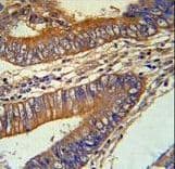 Polyclonal Rabbit anti-Human KLC3 Antibody (aa245-274, IHC, WB)
