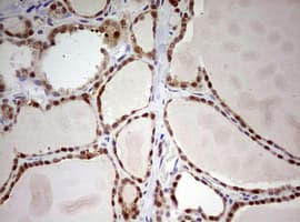 ARFL3 / ARL3 Antibody (aa2-182, clone OTI2G7)