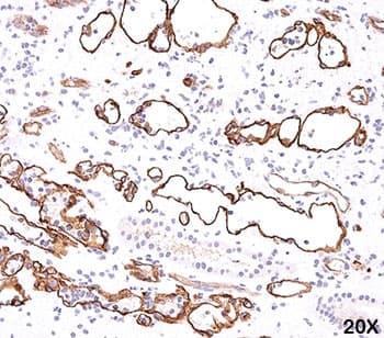 Complement C4d Antibody (clone C4D204)