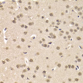 CSNK1E / CK1 Epsilon Antibody