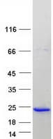 Human CPLX1 / Complexin 1 Protein (Recombinant Myc-DDK (Flag))