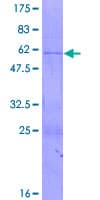 Human RNASEH1 Protein (Recombinant GST)