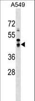 IHC-plus™ SAV1 / WW45 Antibody (aa65-92)