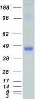 Human TRIB1 Protein (Recombinant Myc-DDK (Flag))