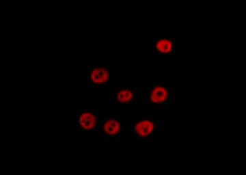 PRKAA1 / AMPK Alpha 1 Antibody (phospho-Ser485,pSer491)