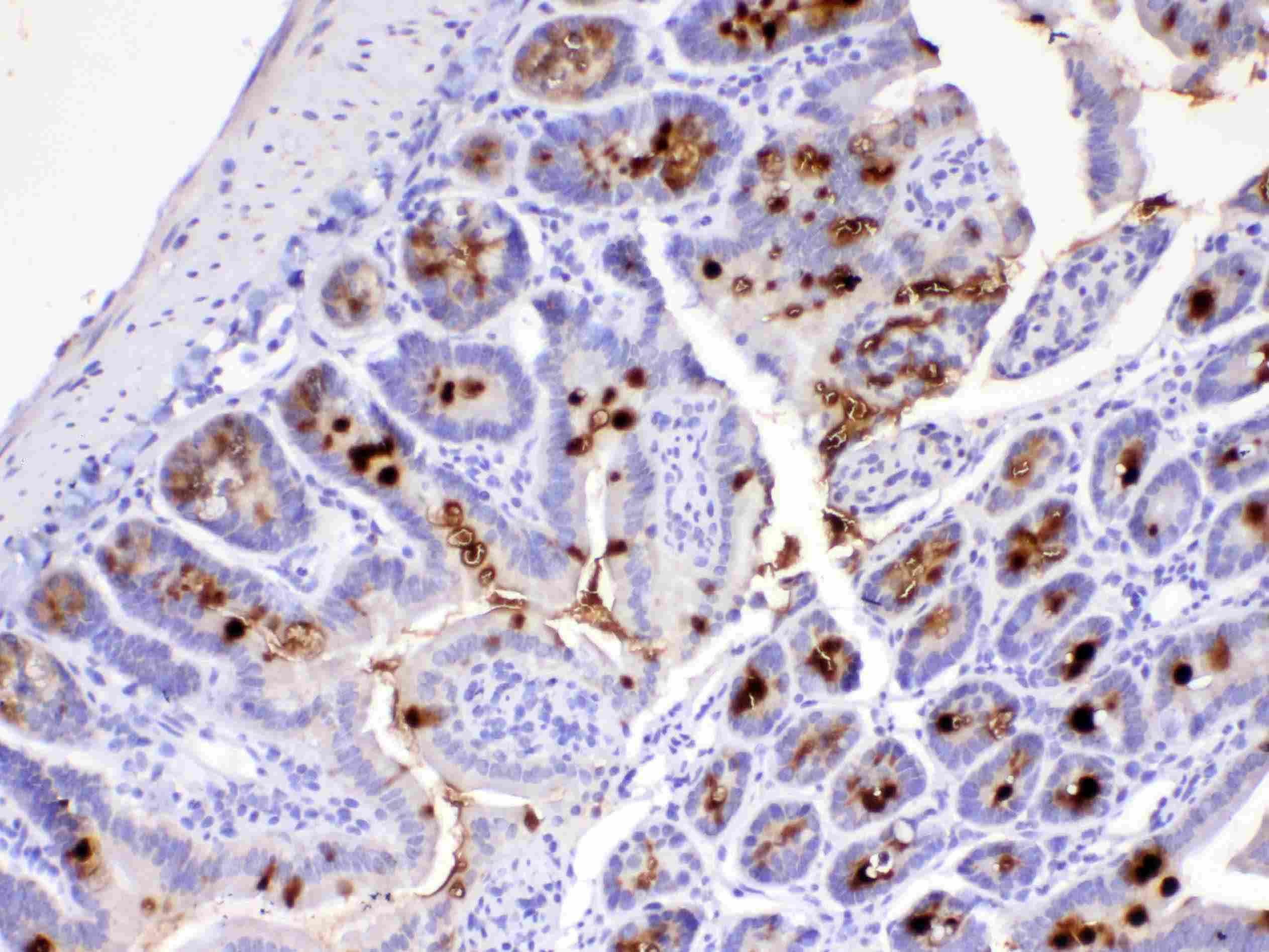 Polyclonal Rabbit anti-Human Mucin 2 / MUC2 Antibody (IHC)