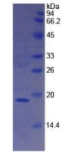 Human F8 / FVIII / Factor VIII Protein (Recombinant His, C-Terminal)