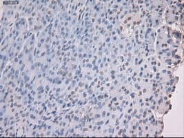 NOG / Noggin Antibody (clone OTI1C1)