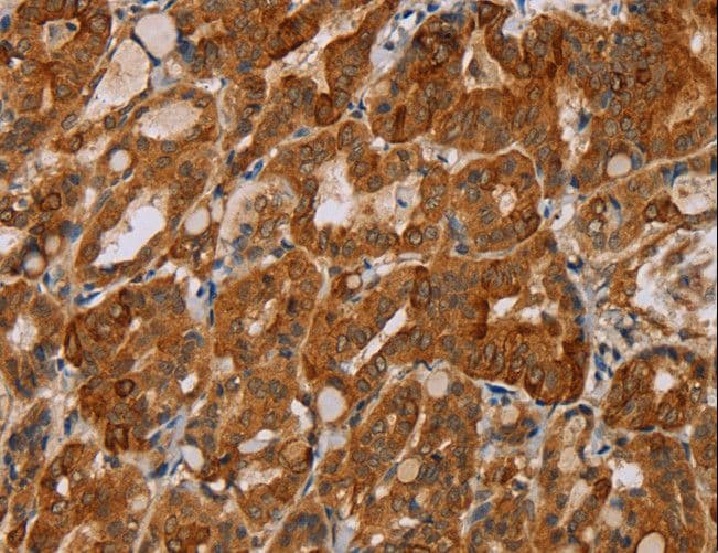 Polyclonal Rabbit anti-Human MTUS1 Antibody (IHC)