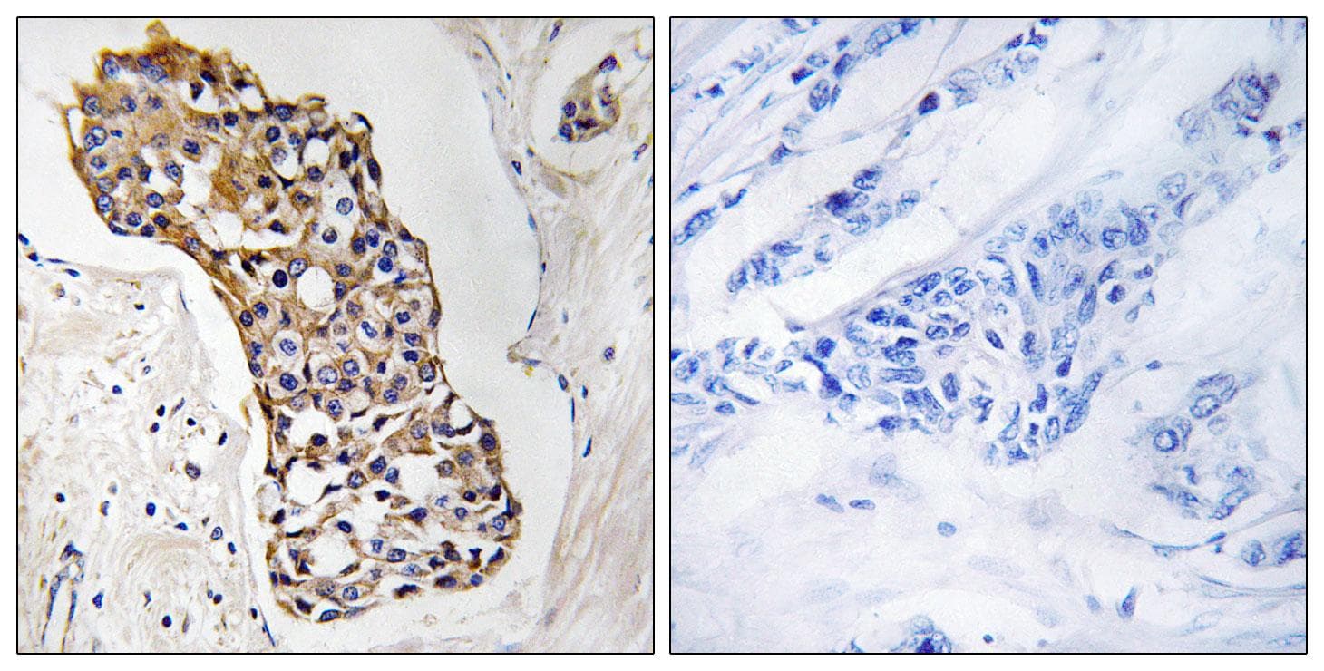 Polyclonal Rabbit anti-Human HSD11B1 / HSD11B Antibody (IHC, WB)