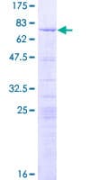 Human LYAR Protein (Recombinant GST)