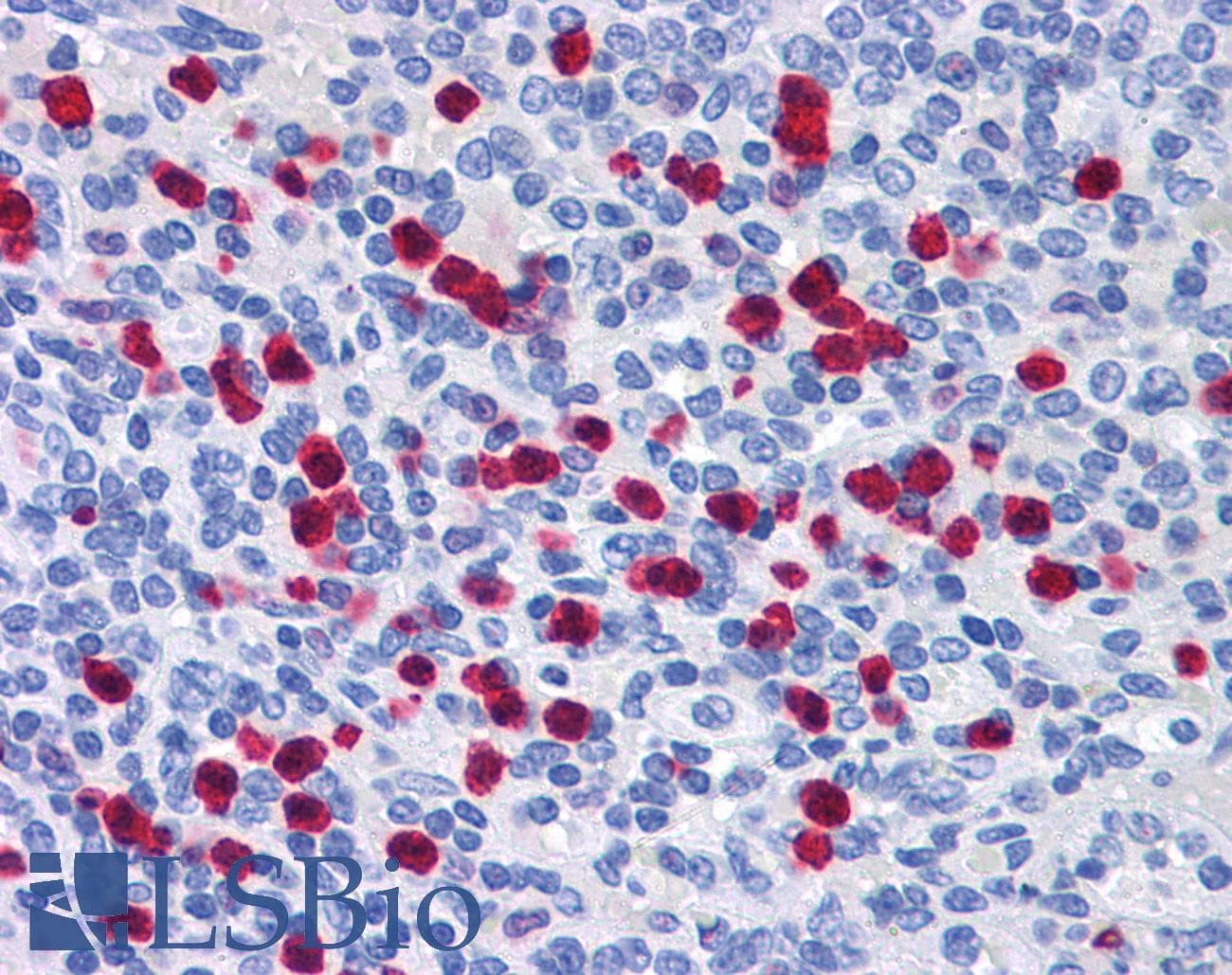 IHC-plus™ GCC2 Antibody (aa1174-1185)