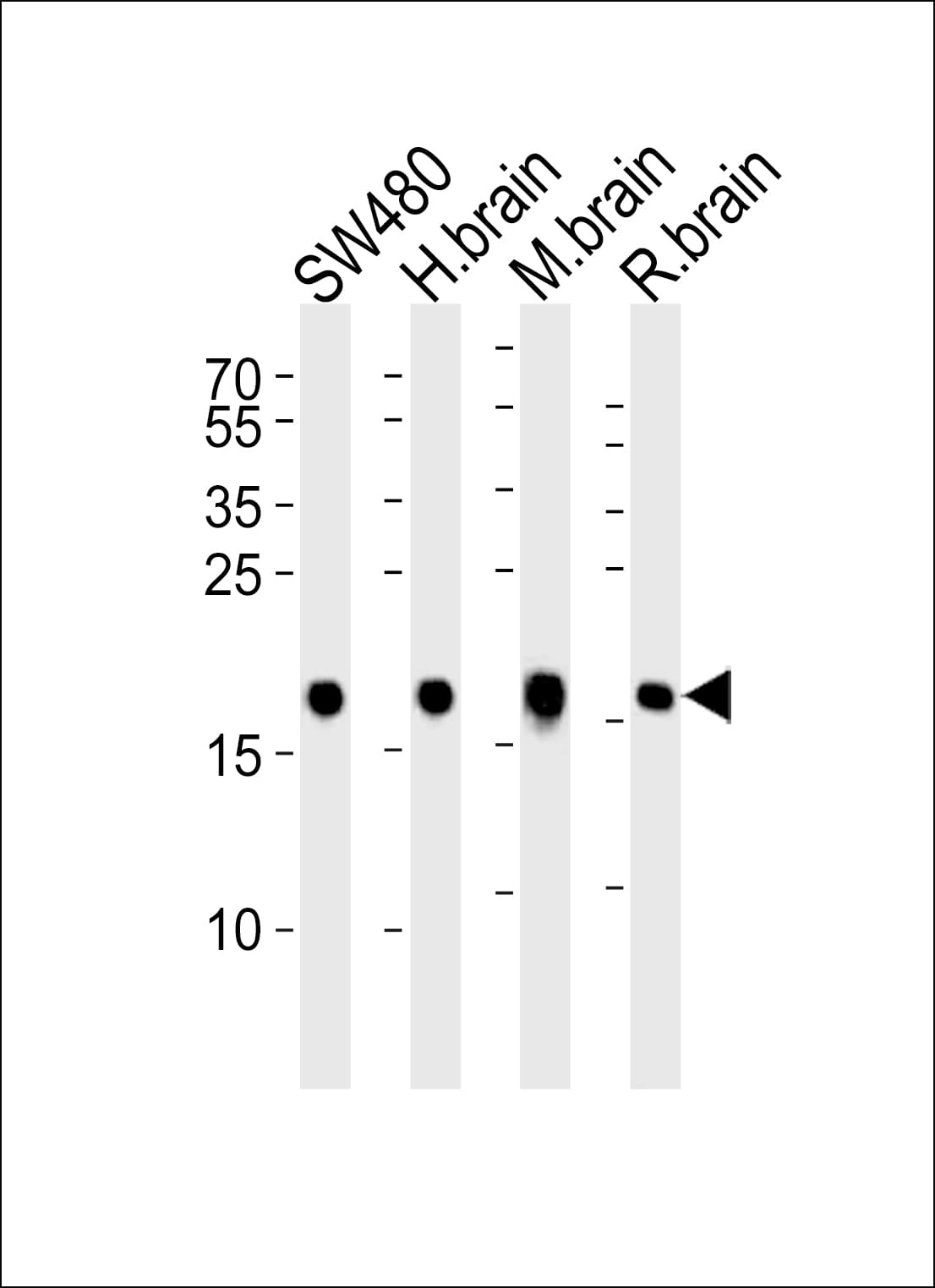 VILIP / VSNL1 Antibody (aa123-150)