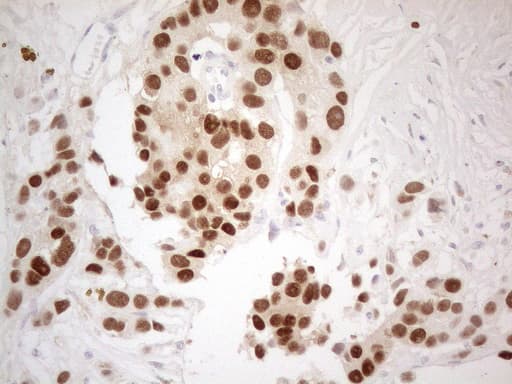 ER Alpha / Estrogen Receptor Antibody (aa1-310, clone OTI5E11)