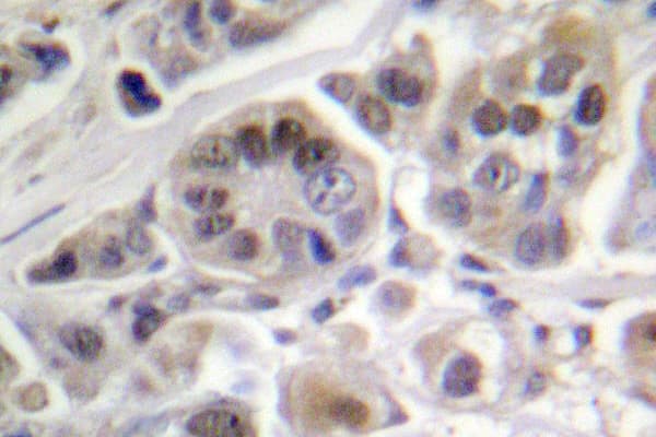 TP53 / p53 Antibody (Arg375)
