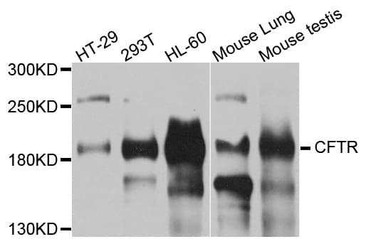 CFTR Antibody