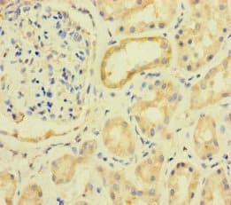 PRKAA2 / AMPK Alpha 2 Antibody