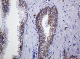 CDH1 / E Cadherin Antibody (clone OTI3E2)