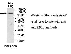 Polyclonal Rabbit anti-Human ALS2CL Antibody (C-Terminus, WB)
