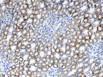 RPS6 / Ribosomal Protein S6 Antibody