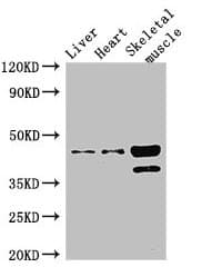 ACAD8 Antibody