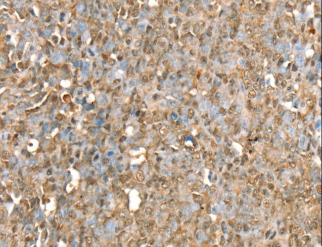 Polyclonal Rabbit anti-Human RBM5 / G15 Antibody (IHC, WB)