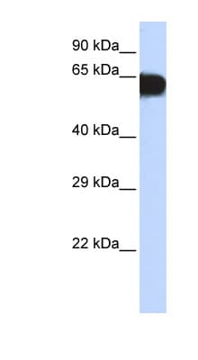 TBX18 Antibody (aa421-470)