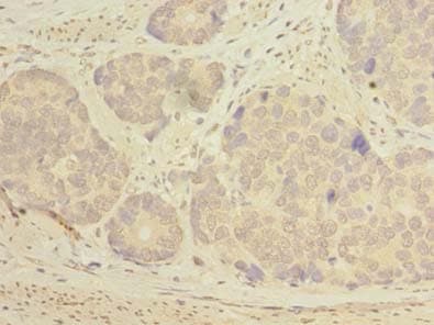 KATNAL2 Antibody