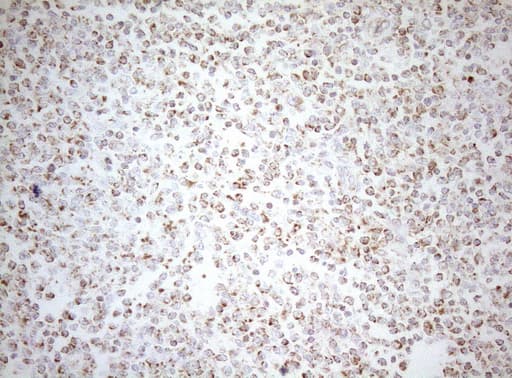 DECR1 Antibody (clone OTI7B11)