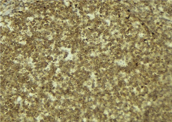 MYCBP Antibody