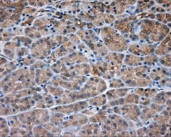 PRKAR2A Antibody (clone OTI1B4)