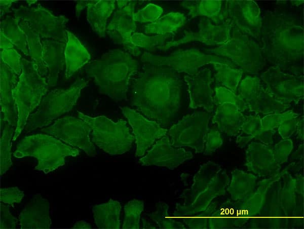 CCK4 / PTK7 Antibody (clone 4C6)