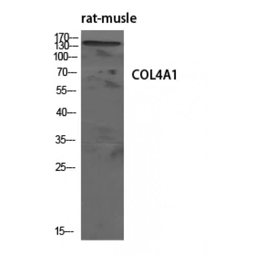 COL4A1 / Collagen IV Alpha1 Antibody (30-110 aa, N-terminal)