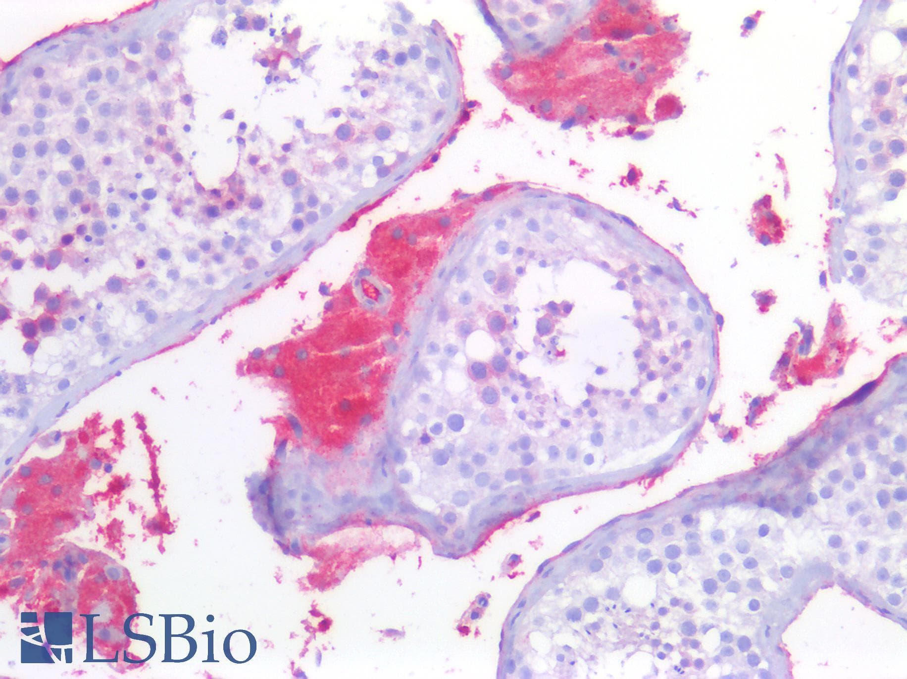 PathPlus™ STK11 / LKB1 Antibody (clone 27D10)