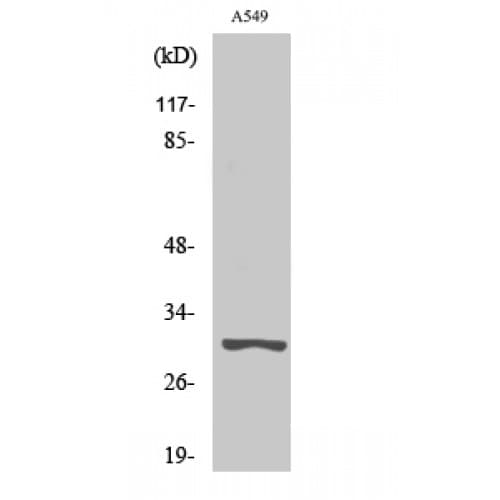 PRSS3 / Trypsin 3 Antibody (Internal)