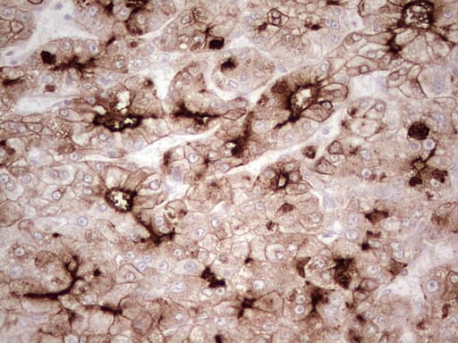 ABCB1 / MDR1 / P Glycoprotein Antibody (aa995-1280, clone OTI1A7, Carrier-free)