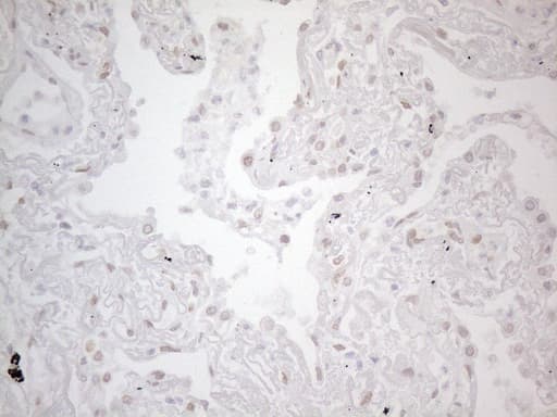 TLK2 Antibody (aa1-296, clone OTI2D10)