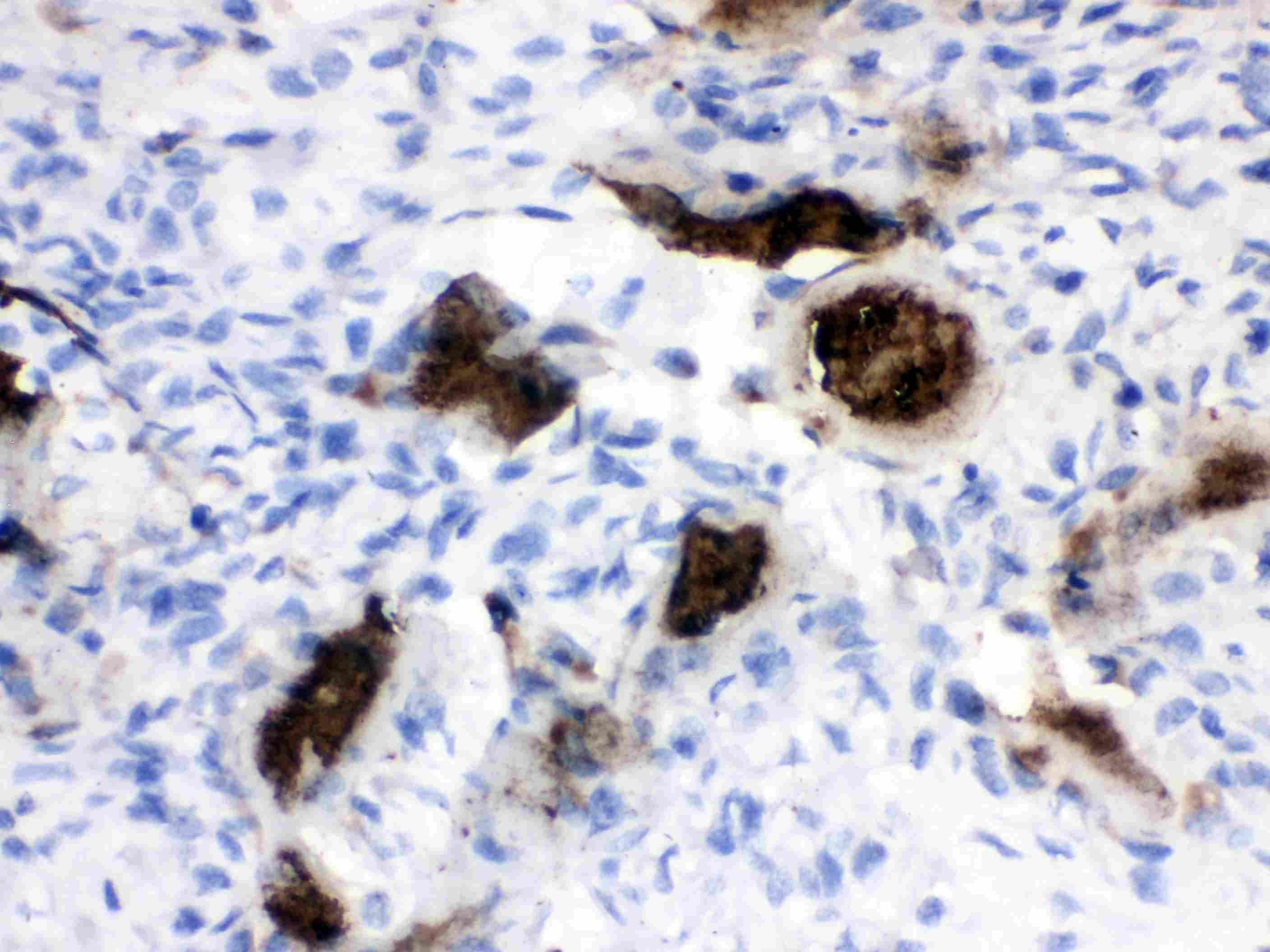Osteocalcin Antibody