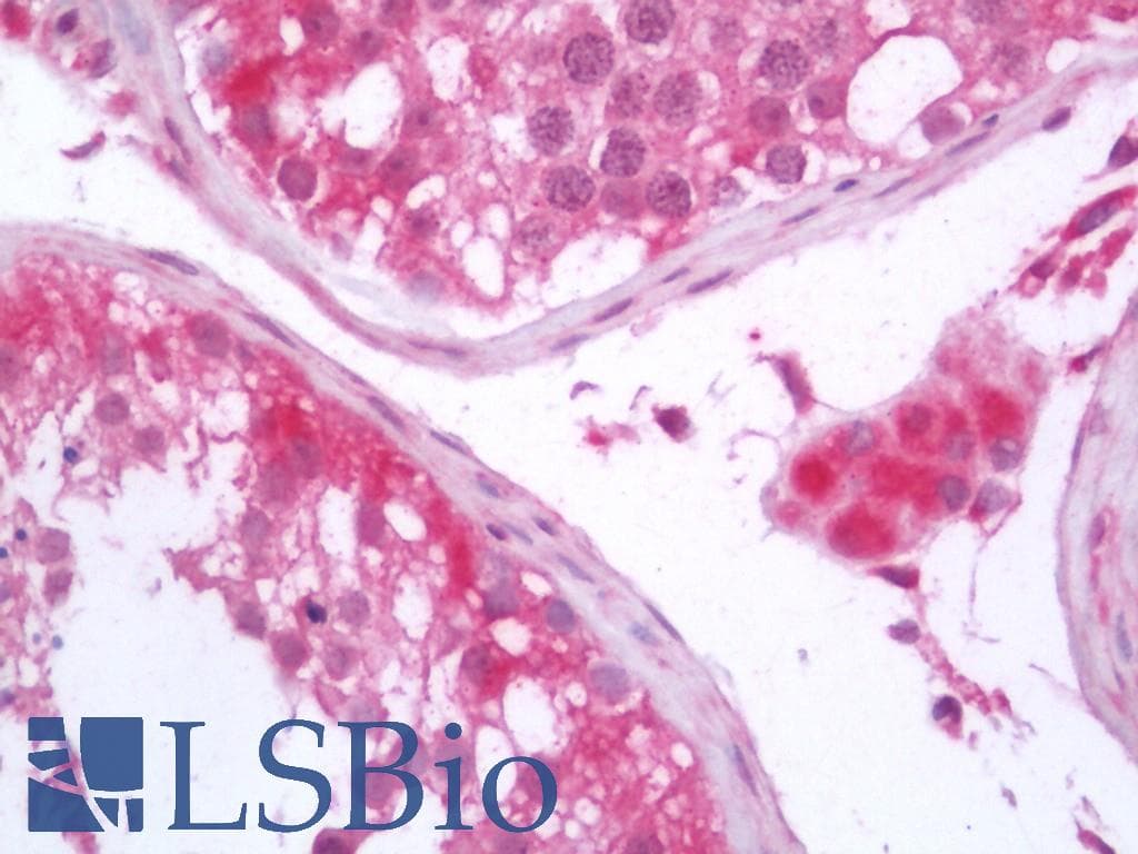IHC-plus™ STARD7 Antibody