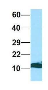 RPL36AL Antibody (C-Terminus)