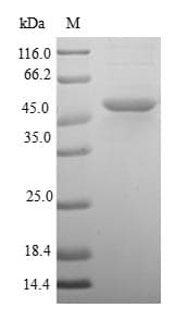 Human DUSP22 / JSP 1 Protein (Recombinant GST, N-terminus)