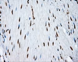 Monoclonal Mouse anti-Human ACLY / ATP Citrate Lyase Antibody (clone 3G8, Carrier-free, IHC, IF, WB)