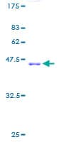 Human RPL11 / Ribosomal Protein L11 (Recombinant GST)