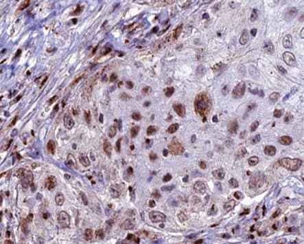 CDKL4 Antibody