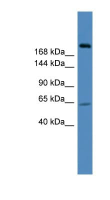 Polyclonal Rabbit anti-Human USP9X / FAM Antibody (C-Terminus, WB)